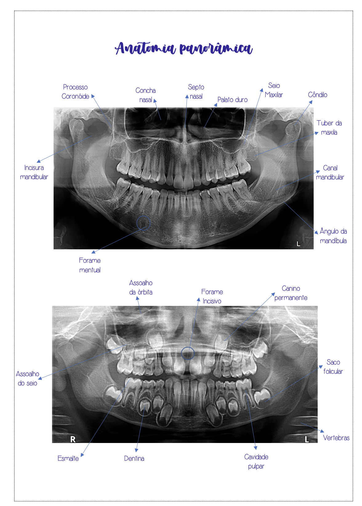 Página ilustrada sobre anatomia panorâmica odontológica