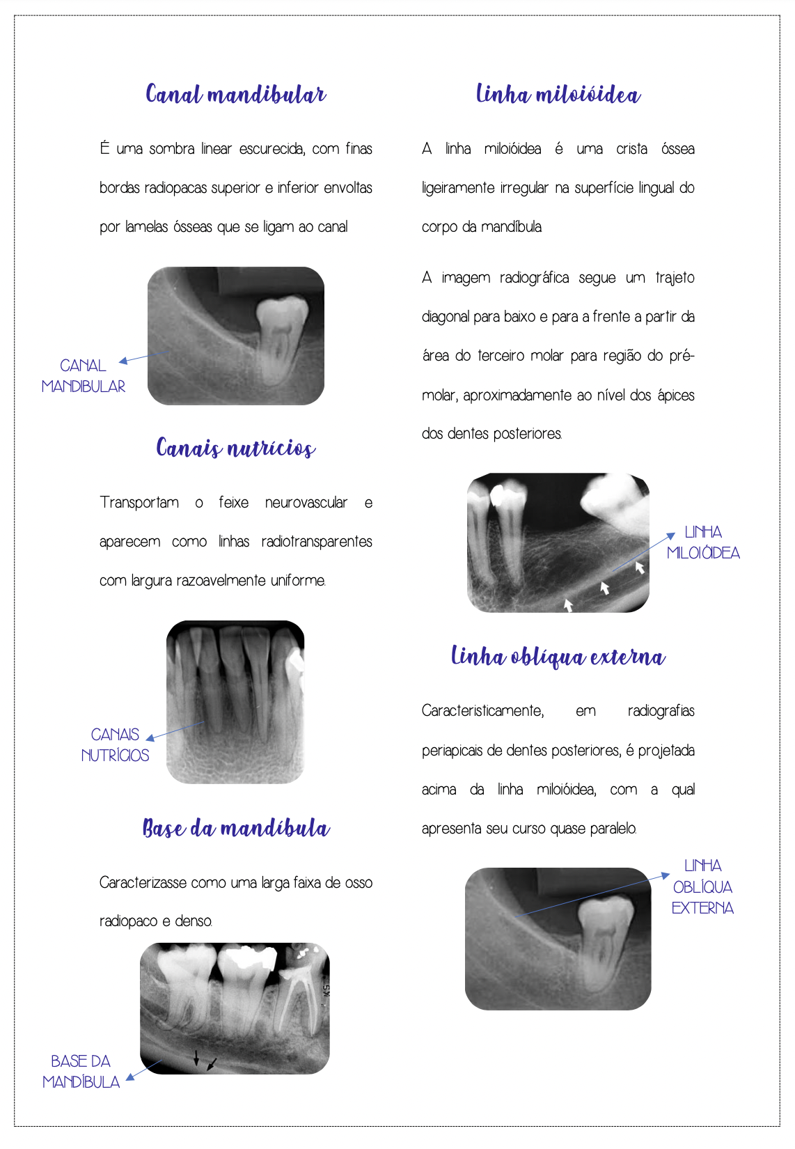 Página ilustrada sobre anatomia radiográfica mandibular