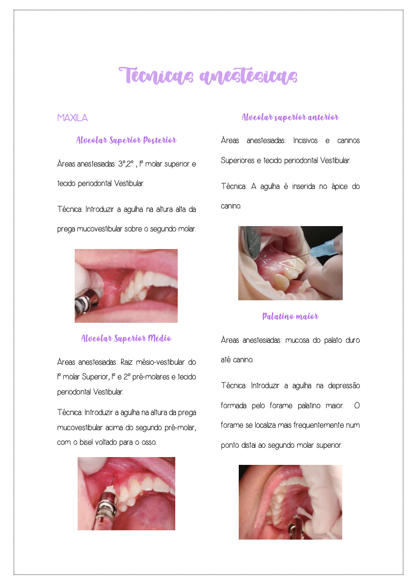 Página ilustrada sobre técnicas anestésicas odontológicas